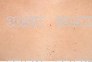 Skin texture of Tracey  0001